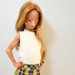 Adalia Rose
