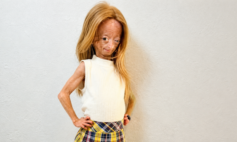 Adalia Rose